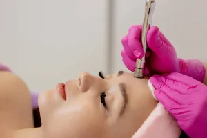 میکرودرم ابریژن
