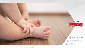 انحراف مچ پای کودک به داخل و خارج-کلینیک نسخه.
