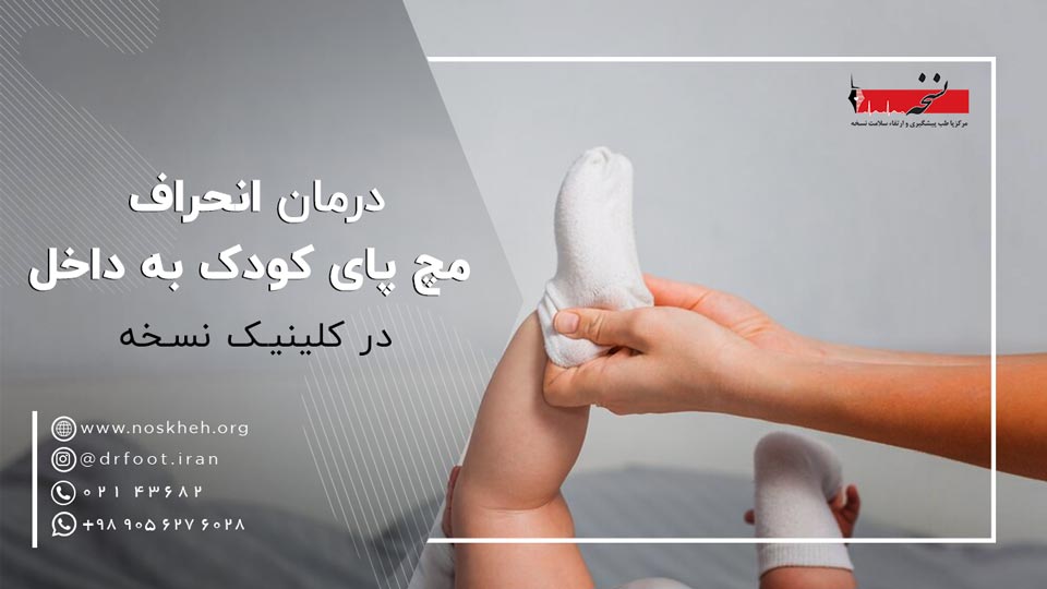 انحراف مچ پای کودک به داخل و خارج-کلینیک نسخه.