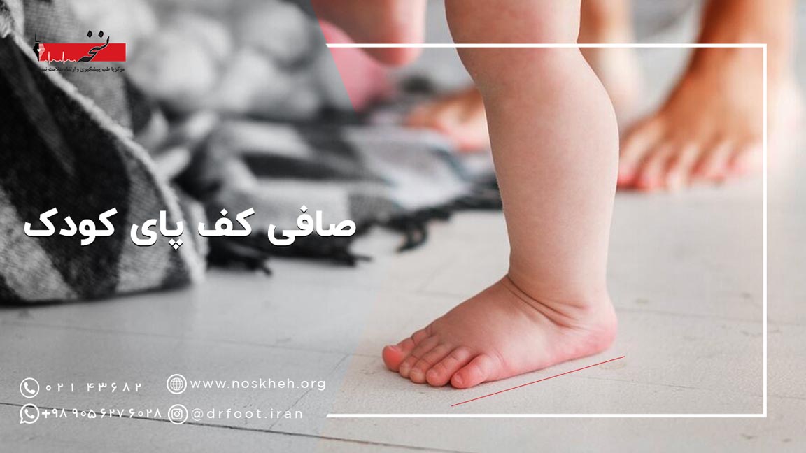 درمان صافی کف پای کودک